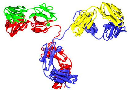 amyloidosis