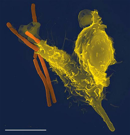 Neutrophils