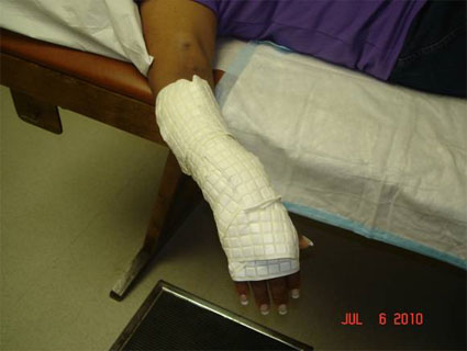Purple Cast