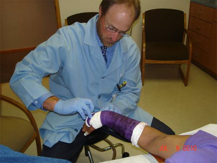 Purple Cast