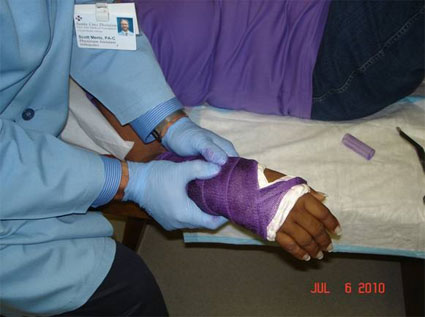 Purple Cast