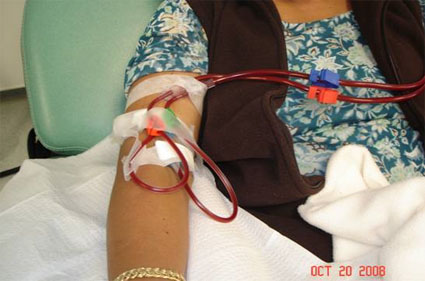 Dialysis