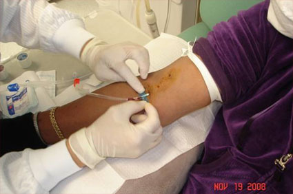 dialysis