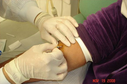 dialysis