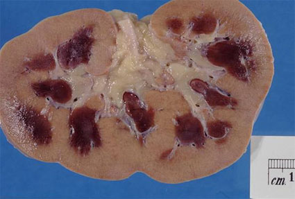 Kidney