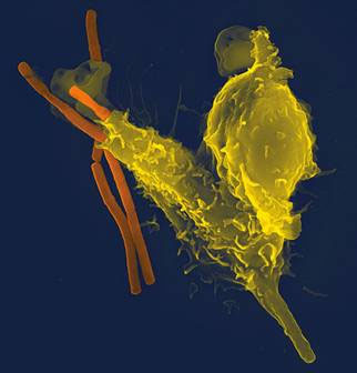 Neutrophil with Anthrax