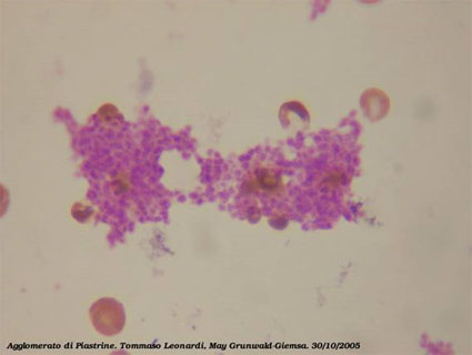platelets