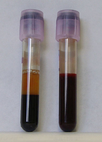 Test Tubes