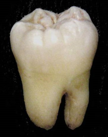 tooth